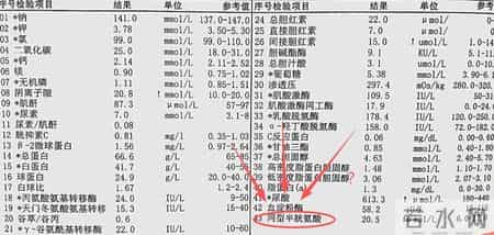 体检报告里这一项异常，竟是脑梗信号？9成人都不重视，后悔太晚