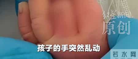 太离谱！新生儿手指被当脐带剪断，脸涨红，哭得撕心裂肺
