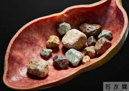 胆结石增多，和高脂餐有关吗？提醒：真正促进结石的是这3个习惯