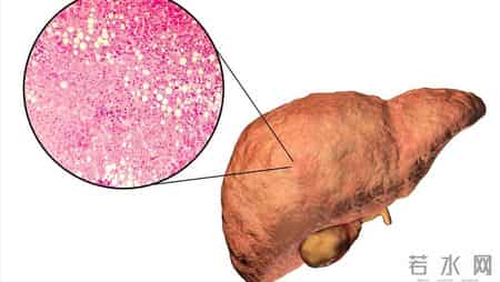 研究发现：62岁后常吃鸡蛋，患肝癌风险是不吃鸡蛋的数倍？真的吗