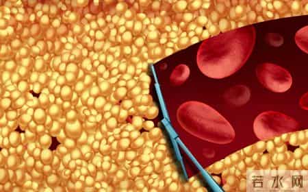 吃了十年他汀才明白：瑞舒伐他汀这6个秘密，很多老病号都不知道