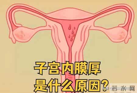 查出子宫内膜厚！调整生活方式真的有用吗？医生给你唠明白