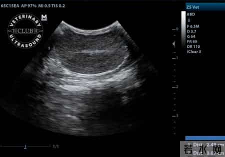 多名医生提醒：只要做过前列腺B超，中老年男性务必重视这2指标！