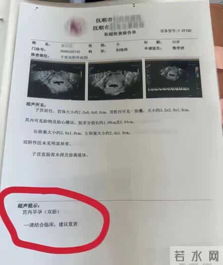 罕见！辽宁一孕妇两个月内产检从一胎“变”四胞胎