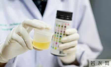 肾脏开始衰竭，排尿先知？医生提醒：排尿出现3异常，尽快去医院