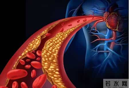 高龄老人不用吃他汀？权威研究：73岁以上高危者吃了更长寿