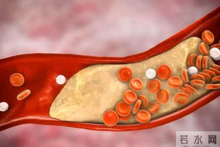 医生调查发现：不吃花生和鸡蛋的人，胆固醇马上就降低了？可信吗