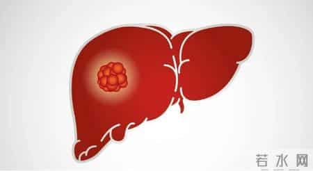 研究发现：57岁后常吃鸡蛋，患肝癌风险是不吃鸡蛋的数倍？真的吗