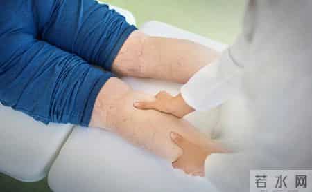 以为是腿痛，结果是血栓！老年人若发现这些症状，可别大意，及时检查