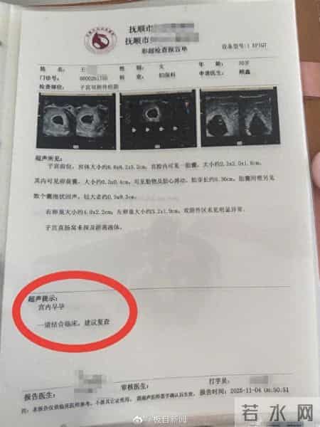 1300万分之一！抚顺孕妈怀同卵四胞胎，第四胎无心靠三胎供血