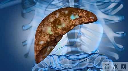 一滴也别喝！科学家发现，2020年全球有74万人因饮酒患癌