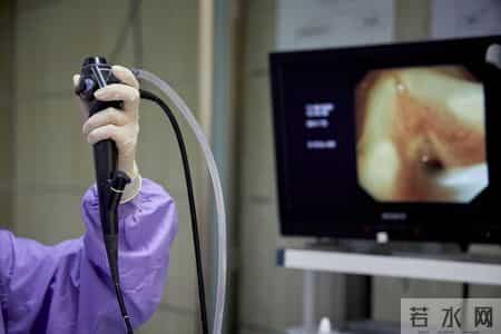 为啥很多人不愿意做肠镜？美国研究：做一次肠镜，或保十年安全？