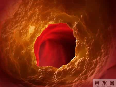 越来越多的人心梗离世！医生再三提醒：少吃芹菜，多吃这几种食物