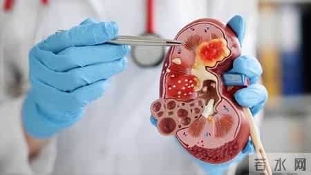 他汀立新功！研究发现：这5种他汀不仅不伤肝，或还降低肝癌风险