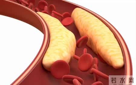南京大学研究：低密度胆固醇越低，癌症风险越高？控制到多少才好