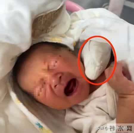 太离谱了！手指被当脐带剪断，新生儿脸涨红哭得撕心裂肺，好心疼
