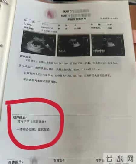 罕见！辽宁一孕妇两个月内产检从一胎“变”四胞胎