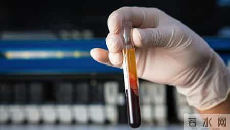 什么样的糖化血红蛋白最危险？专家：这5种异常，你了解吗