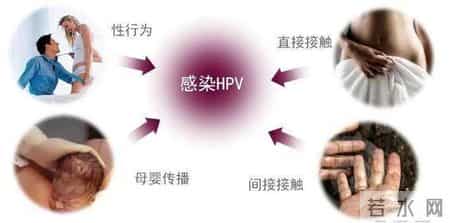 HPV阳性先别慌，千年古方一味药，提高抵抗力