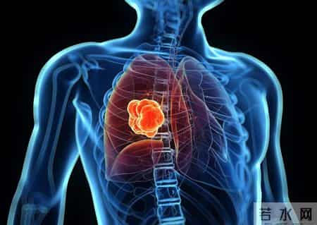 多名医生提醒：只要做过前列腺B超，中老年男性务必重视这5指标！