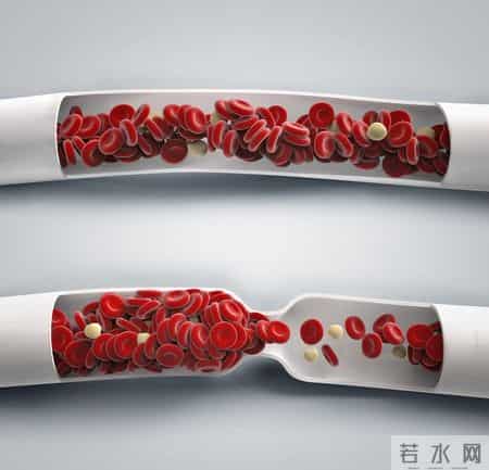 超百万人群研究：长期低剂量他汀，或与癌症风险降低存在关联性