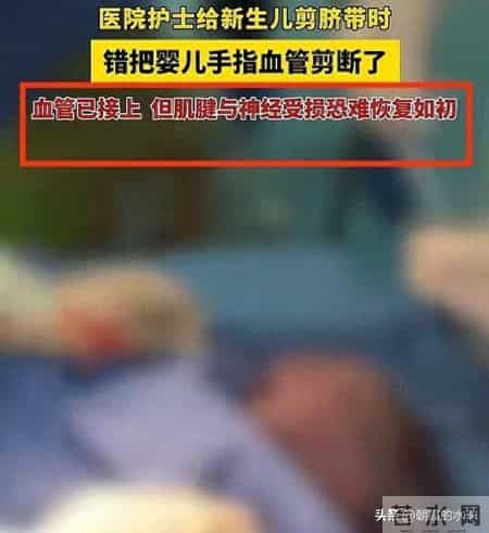 离谱！婴儿刚出生手指被当脐带剪断，全家心碎
