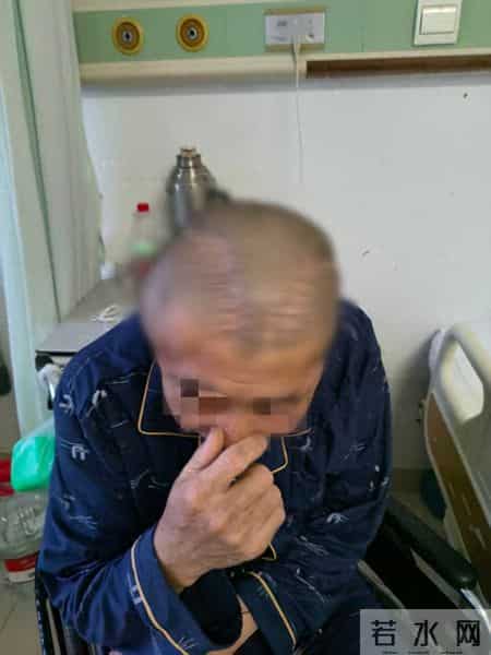 医生开错颅后续：患者没拿到300万赔偿，倒被医院告要160万医药费