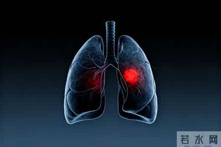 医生忠告：跟肺癌患者一起吃饭，一定要注意4件事，千万别忽视！