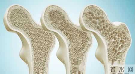 研究发现：每日饮酒的糖尿病人，大多临近60岁或有5种异样