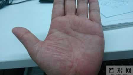 身上4处发痒，竟被确诊癌症！男子崩溃：以为只是简单过敏