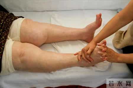 糖尿病加重的5个信号！医生：一旦出现就要重视，千万别拖延了