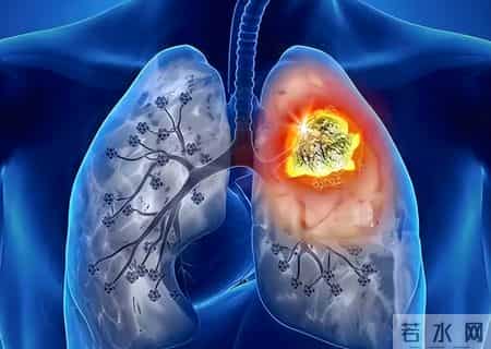 100个烟民中，最后会有几个人得肺癌，英国癌症研究给出解释