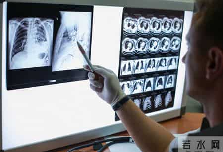 医生提醒：跟肺癌患者一起吃饭，一定要注意5件事，千万别忽视！