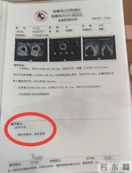 辽宁一孕妇每次产检都多出一胎，两个月内从一胎变四胞胎，医生：概率1300万至1500万分之一