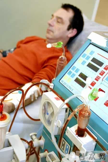 8000万单位一针的干细胞治肾病，到底值不值？疗效与费用全解析