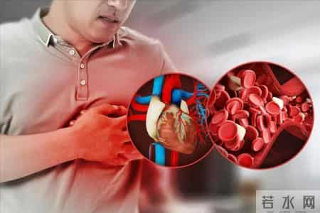 橙子再次被关注！医生发现：常吃橙子的冠心病患者 或出现4种变化