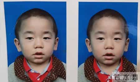 痛心！陕西15岁“巨婴”孙宝去世，妈妈背着爬华山，网友：解脱了