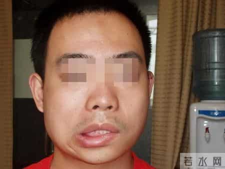 人不会无缘无故患脑卒中！医生发现：得脑卒中患者，离不开这5点