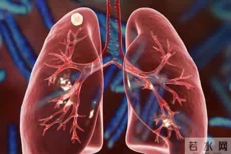 56岁男子3月体检肺结节，年底查出肺癌晚期，医生：5类人要注意