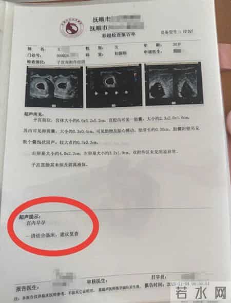 孕妇两个月内从一胎变四胞胎，每次产检都多出一胎！医生：系同卵四胞胎