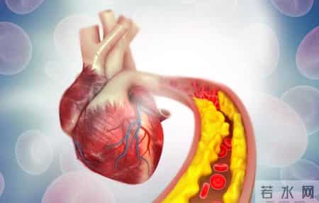 研究发现：低密度脂蛋白降得太低，心脏笑了，大脑可能哭了！