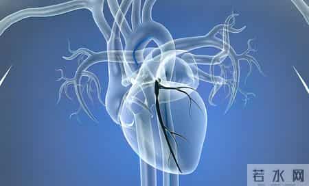 咸菜立大功！研究表明：冠心病患者常吃咸菜，或能改善6种并发症