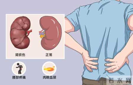 多名医生忠告：慢性肾病患者做过尿检，务必重点看这4项核心结果