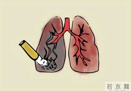多名医生忠告：肺癌高危人群做完低剂量 CT，务必关注 4 项核心征象