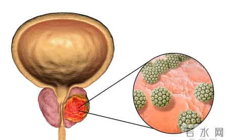 多名医生提醒：只要做过前列腺B超，中老年男性务必重视这3指标！