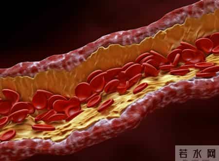 再这样睡觉，血管就要堵死了，老人4种错误的睡觉习惯要纠正