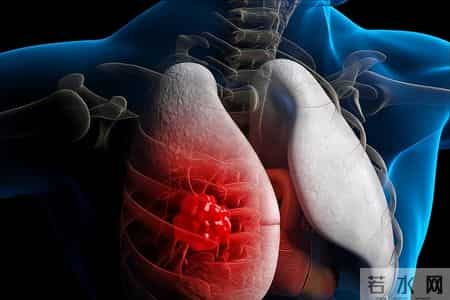 癌症到最后都是咋去世的？医生叹息：去世前，身体有5个征兆