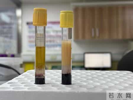 研究发现：57岁后常吃鸡蛋，患肝癌风险是不吃鸡蛋的数倍？真的吗