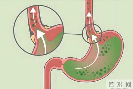 糖友喝牛奶最佳时间：早上喝还是睡前喝？喝错了，血糖越喝越不稳
