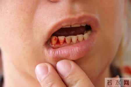 老人吃氯吡格雷要留心！知名医生：和它同服，可能引发致命性出血